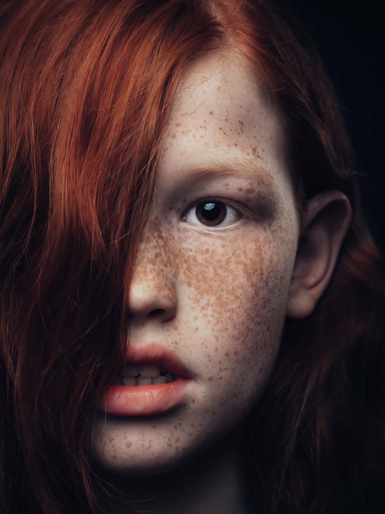 Portret-roodharige-en 1-oog bedekt